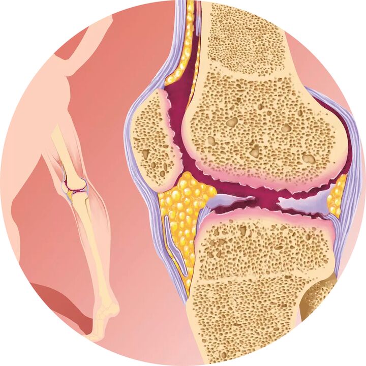 Hondroten unterstützt die Beweglichkeit der Gelenke